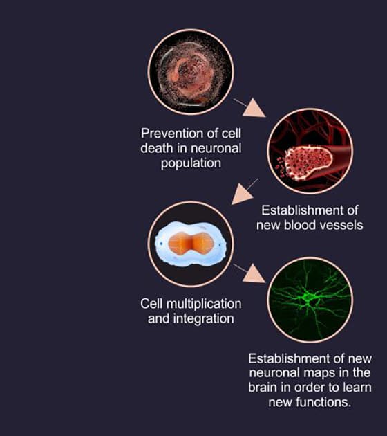 cell therapy For Intellectual Disability, Intellectual Disability