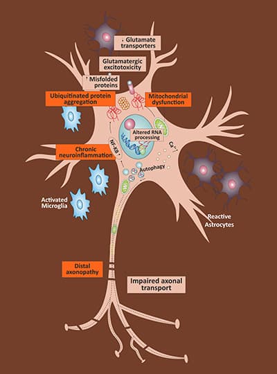 Causes Of Motor Neuron Diseases