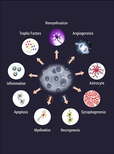 cell therapy For Motor Neuron Diseases