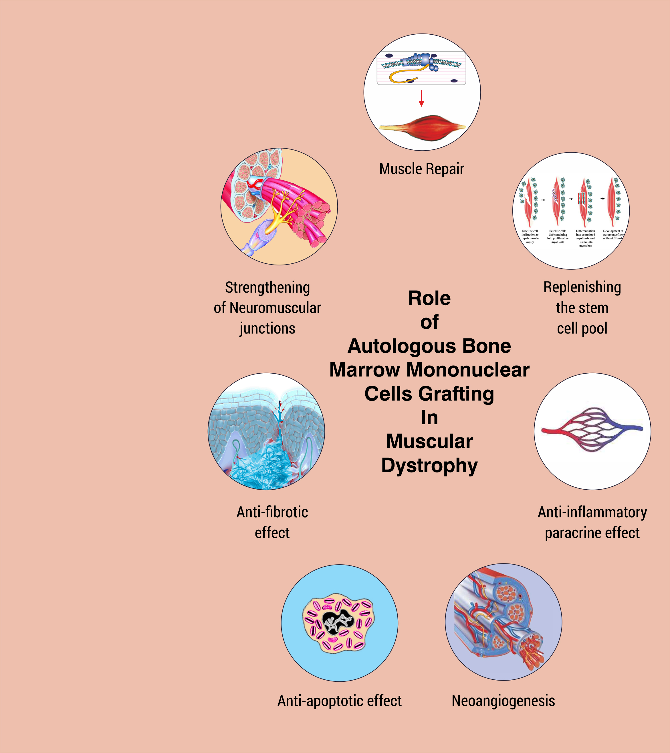 Muscular Dystrophy Causes