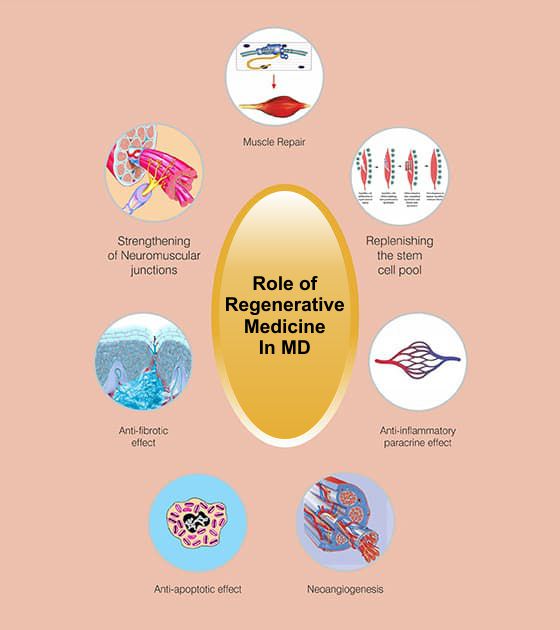 Muscular Dystrophy Causes