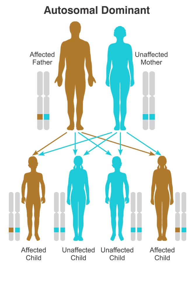 Muscular Dystrophy Treatment