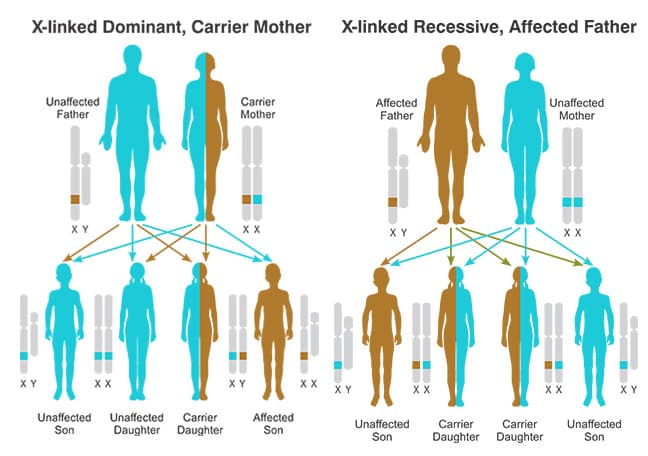 Muscular Dystrophy Treatment