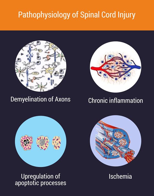 Bone Marrow-Derived Cell Treatment for Spinal Cord Injury