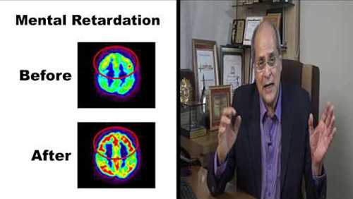 Dr Alok Sharma, Alok Sharma, Neurosurgeon, Virtual Opd