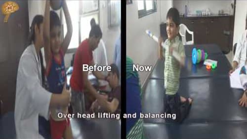Cerebral Palsy Treatment in India
