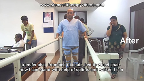 Spnal Cord Injury, Spinal Cord Injury Treatment,